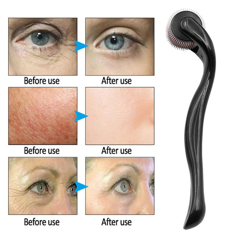 Microneedle Derma Roller for Hair Growth and Beard Care, and Face Skin